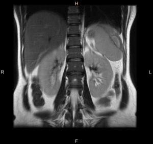 снимок органов брюшной полости на МРТ