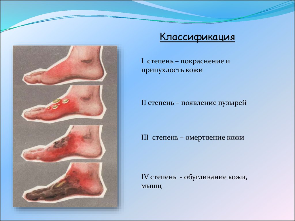 Скайрим том заклинаний обморожение