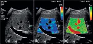 узи печени в Запорожье